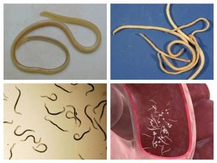 Arten von Würmern im Körper