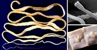 wie zu verstehen, dass die Würmer im Körper
