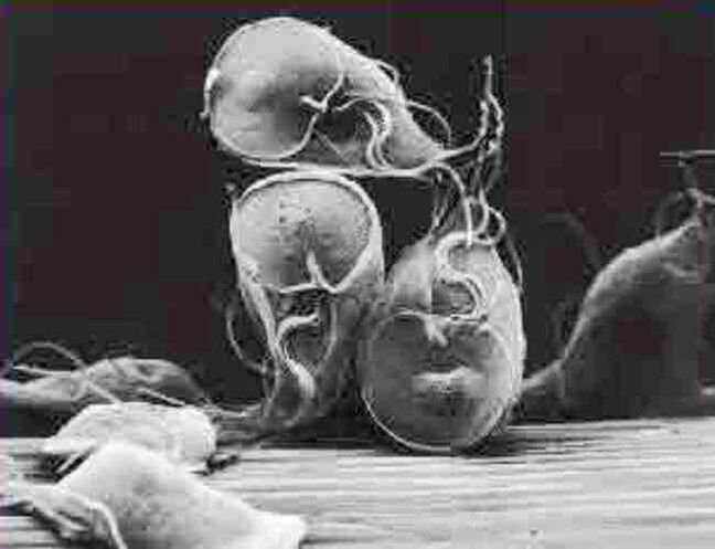 protozoischer Parasit Giardia